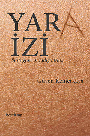 Yara İzi - 1